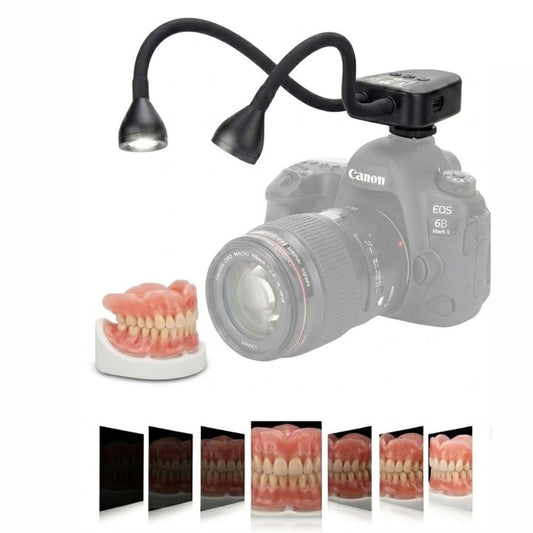 Duale LED-Beleuchtung für Dentalfotografie – Kompatibel mit allen Kameramodellen | Helligkeit in 10 Stufen einstellbar