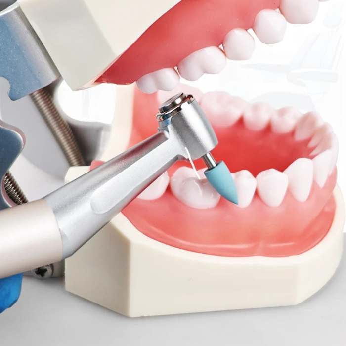 Polier- und Finish-Set für Harz – 12 Teile (Niedrige Geschwindigkeit)