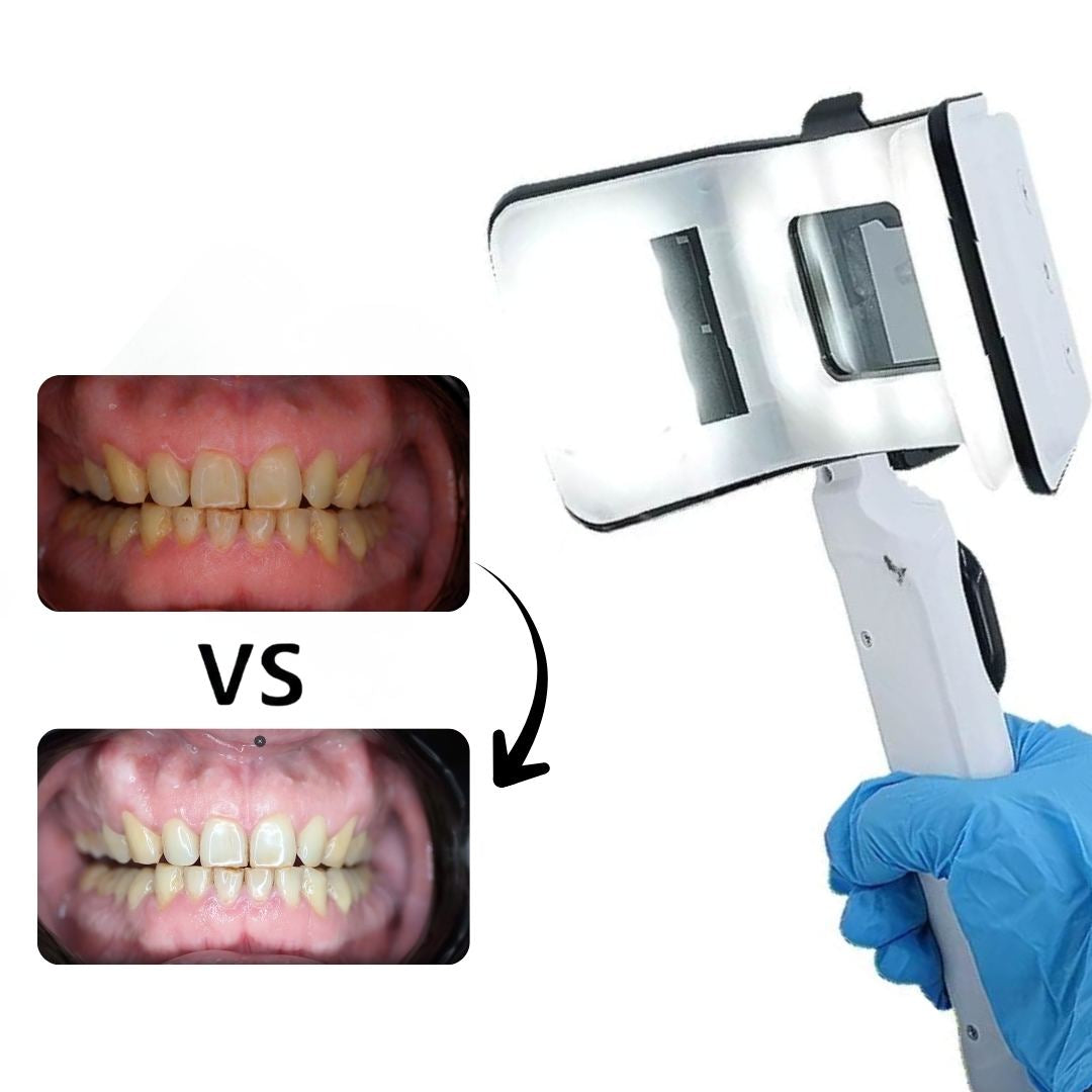 Kit de Beleuchtung Dental M95 mit elektronischer Steuerung für Smartphone