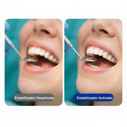 Aufnahmekamera für medizinische, zahnärztliche und ästhetische Eingriffe – 4K bei 30 Bildern pro Sekunde 